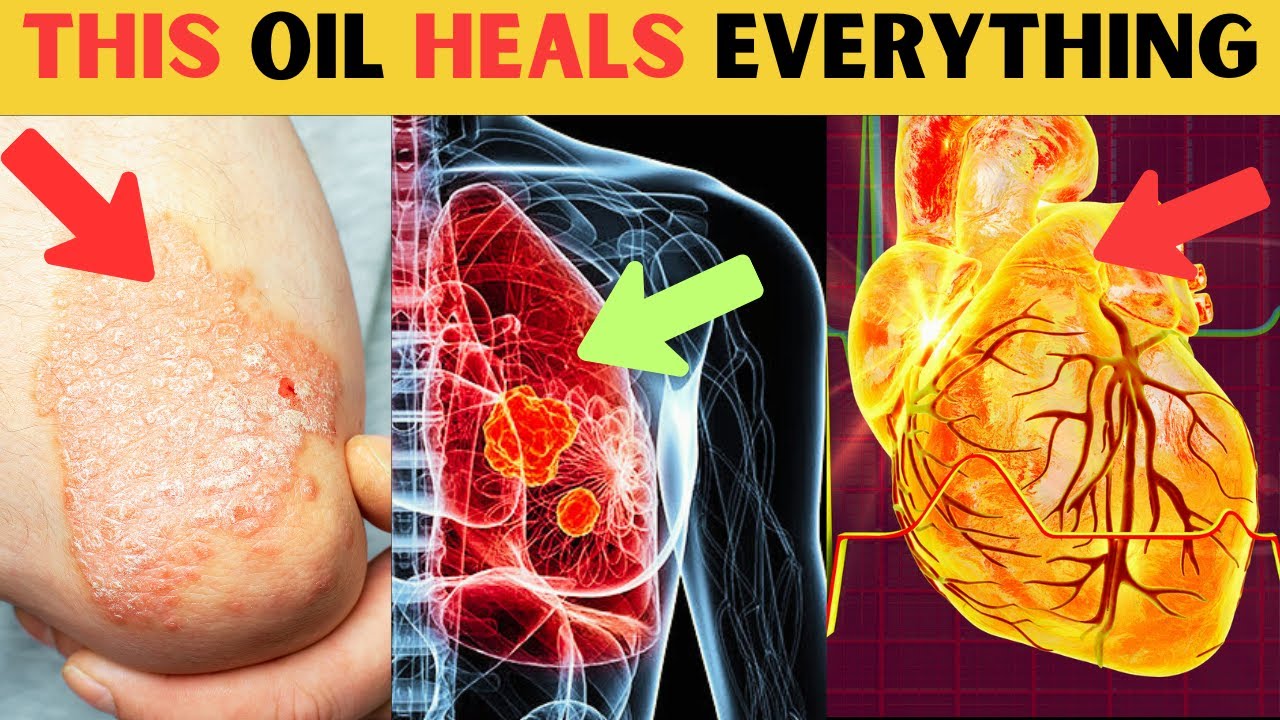 15 Surprising Health Benefits of Black Seed Oil (You&rsquo;ve Never Heard Of)