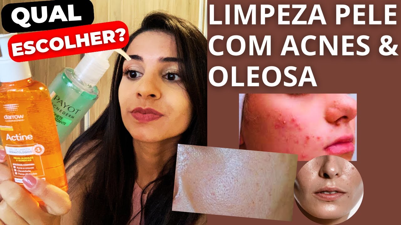 ACTINE GEL X SABONETE PAYOT QUAL ESCOLHER? PELE OLEOSA E ACNEICA