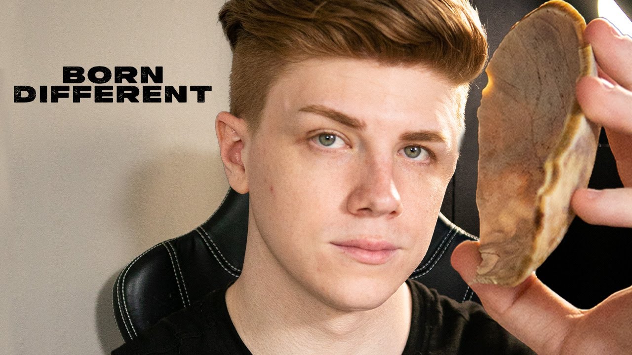 I Lost Half My Skull & No One Knows Why | BORN DIFFERENT
