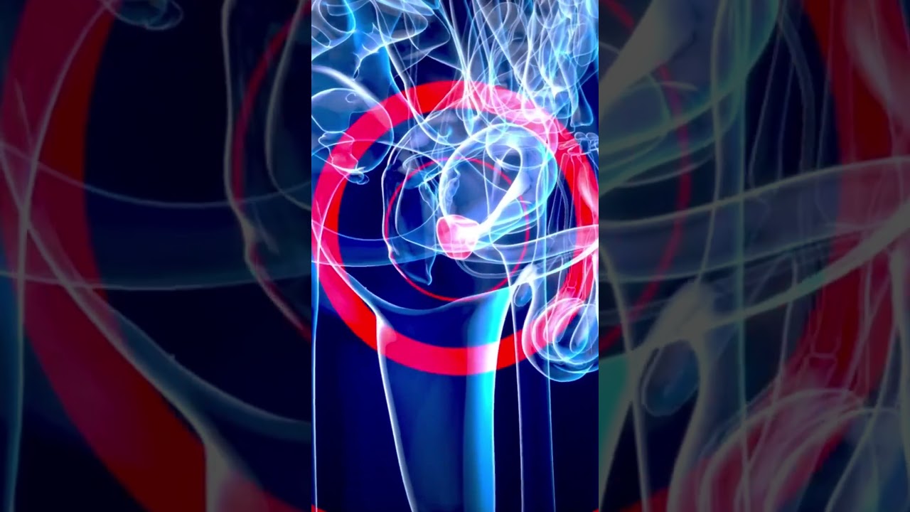 iTIND Unveiled: A New Era in BPH Treatment