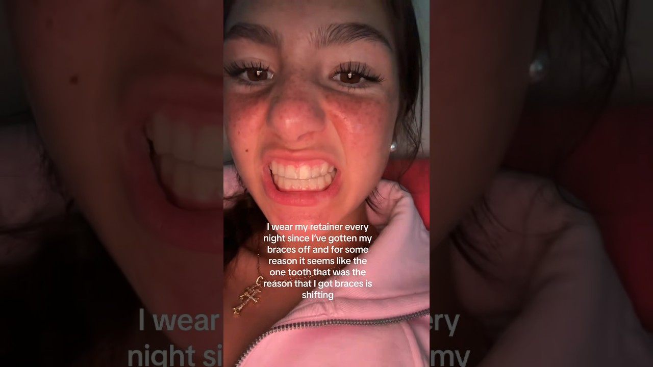 Your Teeth Can Still MOVE In With A Retainer! 😮🦷