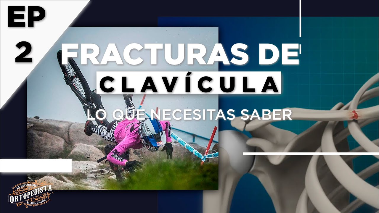 Fracturas de clavícula