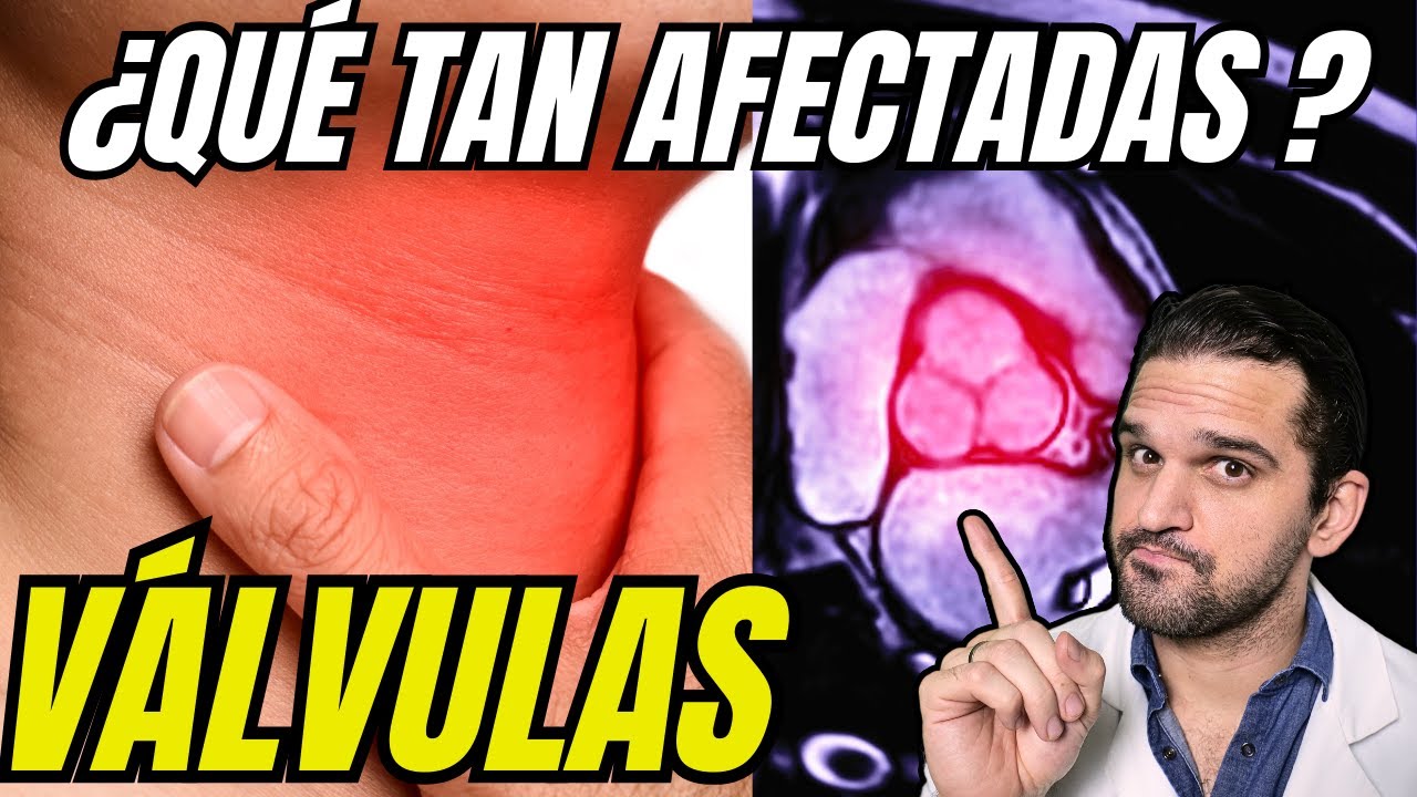 Esto DAÑA tus válvulas cardiacas y se deben operar 🔪🫀