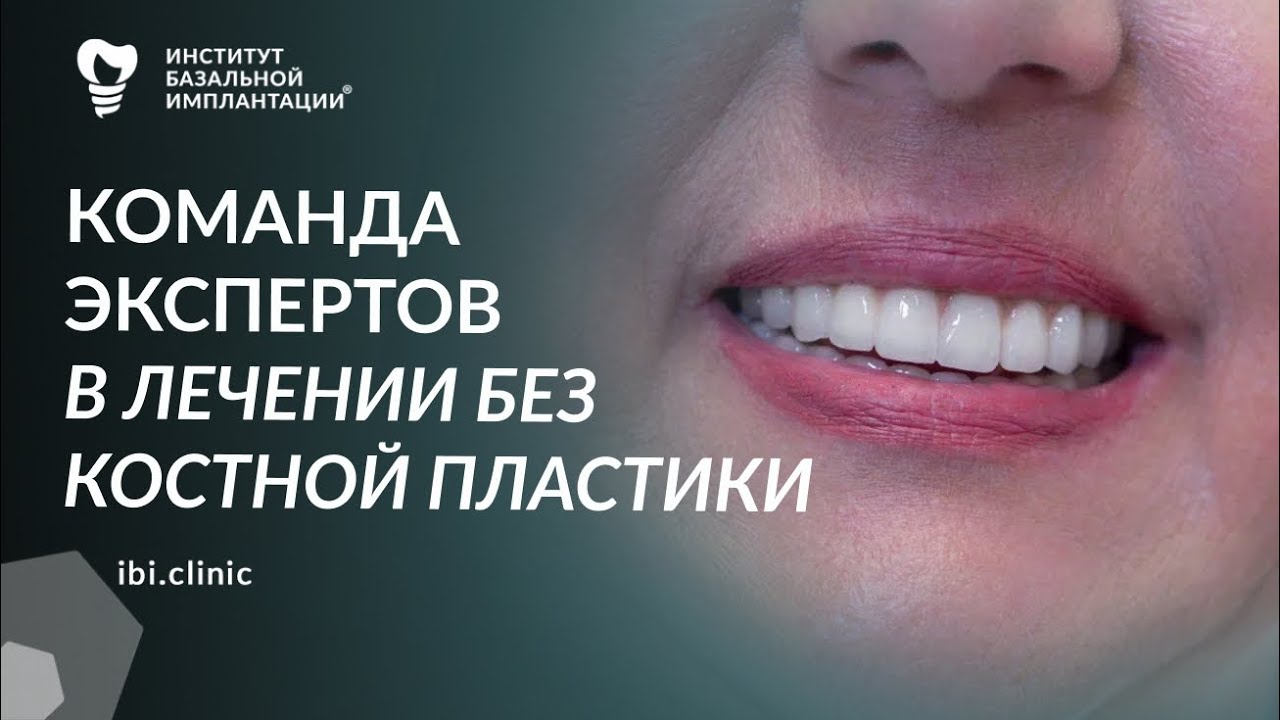 Лечение Зубов без костной пластики: восстановление базальным методом. Отзыв пациента о лечении. 