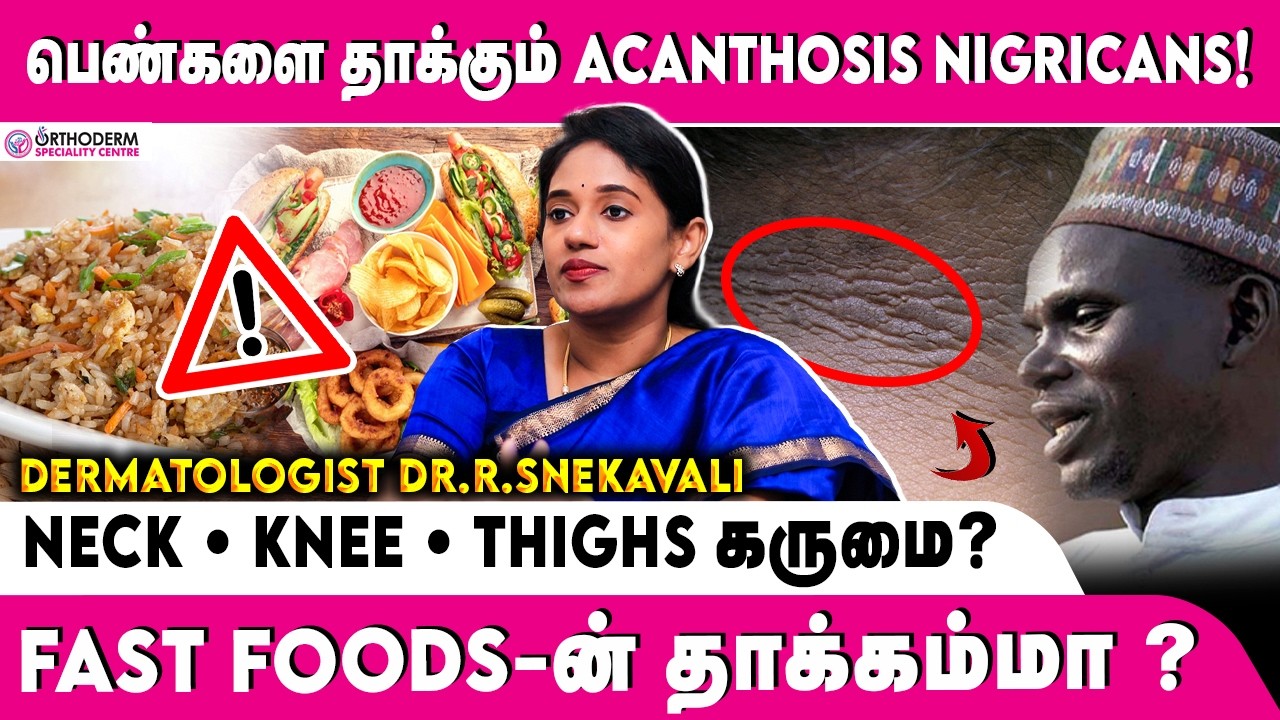 உடலில் கருமை அதிகமா?இது ஒரு முக்கிய REDALERT-ஆக இருக்கலாம்!Acanthosis Nigricans எச்சரிக்கை#skincare