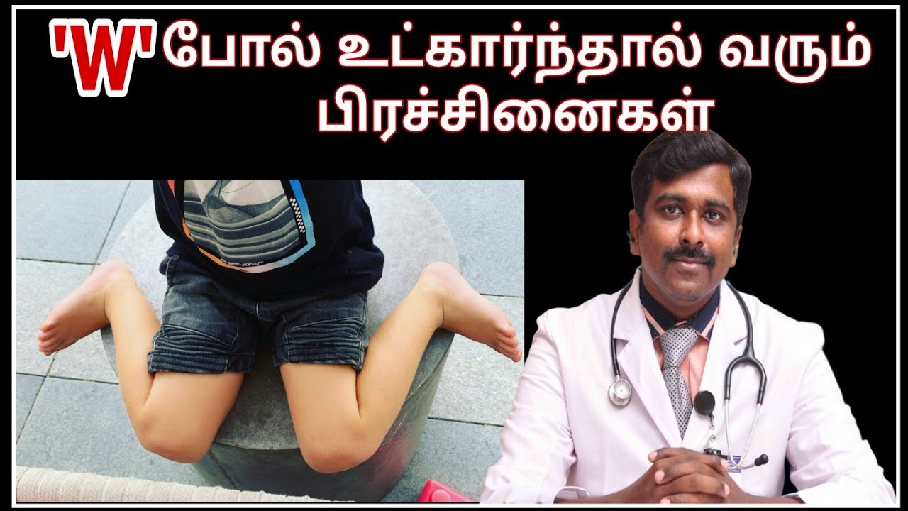 குழந்தைகளை பாதிக்கும் 'W Shaped sitting' | Tamil | Dr Sudhakar|
