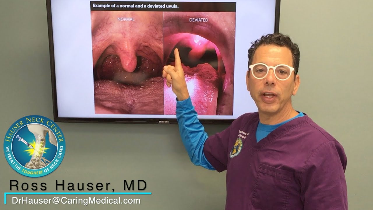 Deviated uvula and vagus nerve degeneration - Say AHHHH!