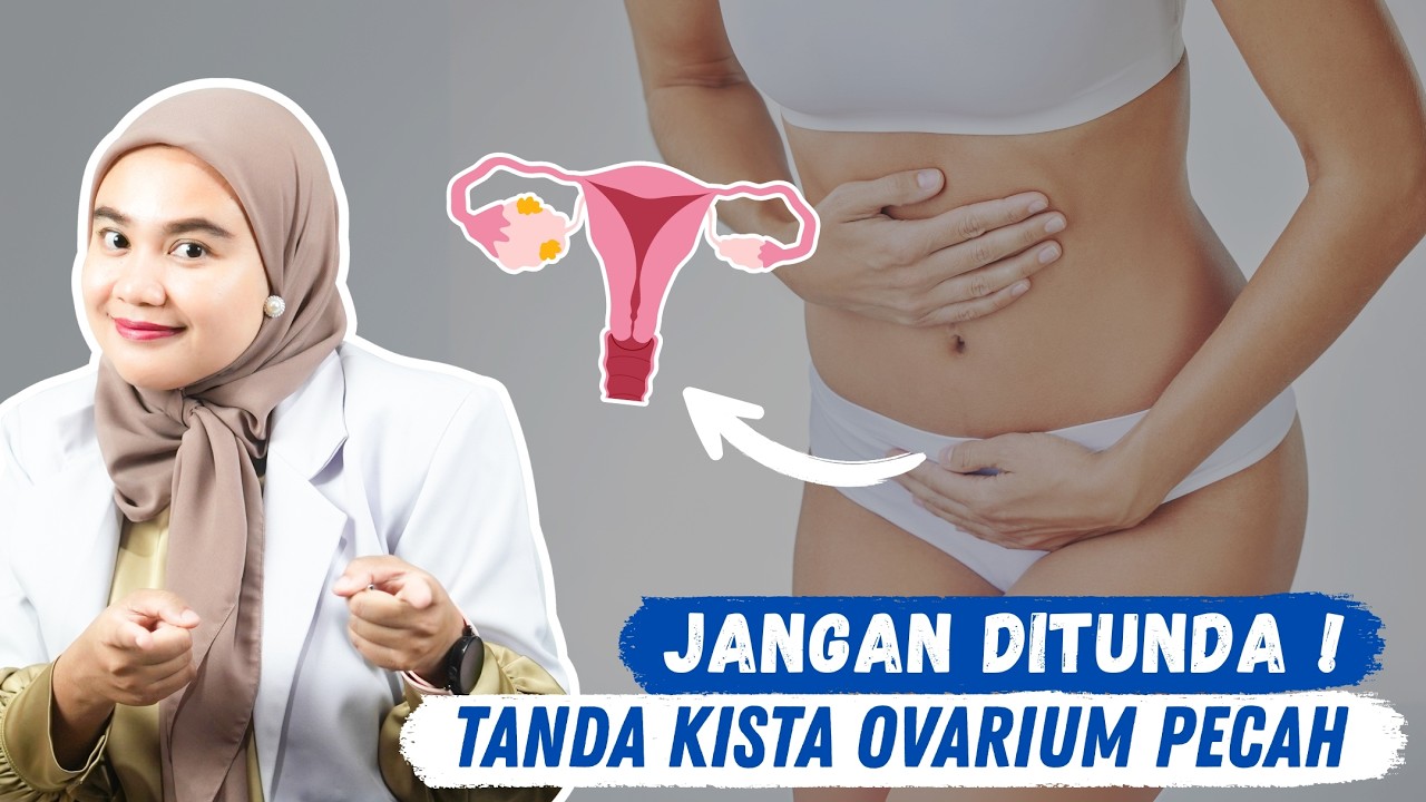 Kenali Gejala KISTA OVARIUM PECAH - DOKTER WSP