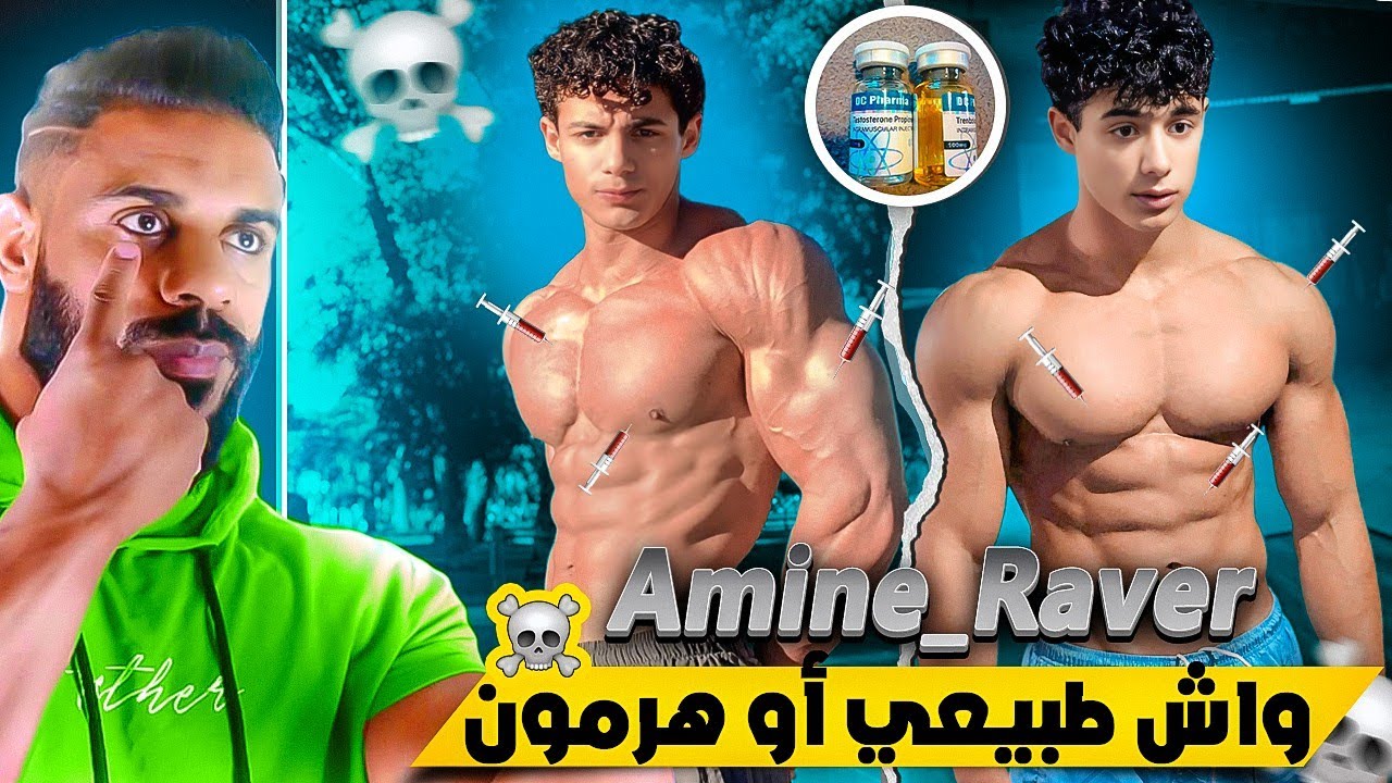 هل هم طبيعيون 🤔 : Amine_Raver واش طبيعي أو دوباج 💉