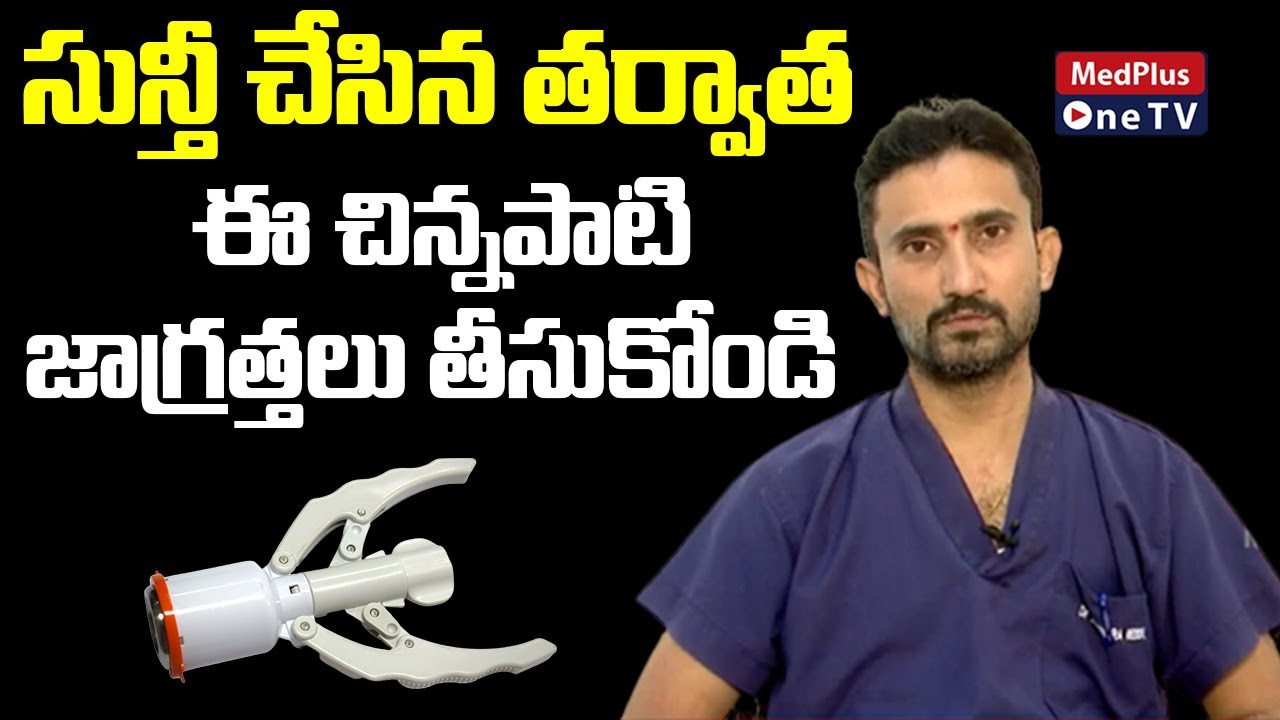 Stapler Circumcision : Know about Stapler Circumcision Surgery | Dr.Surender Reddy | @Medplus One TV