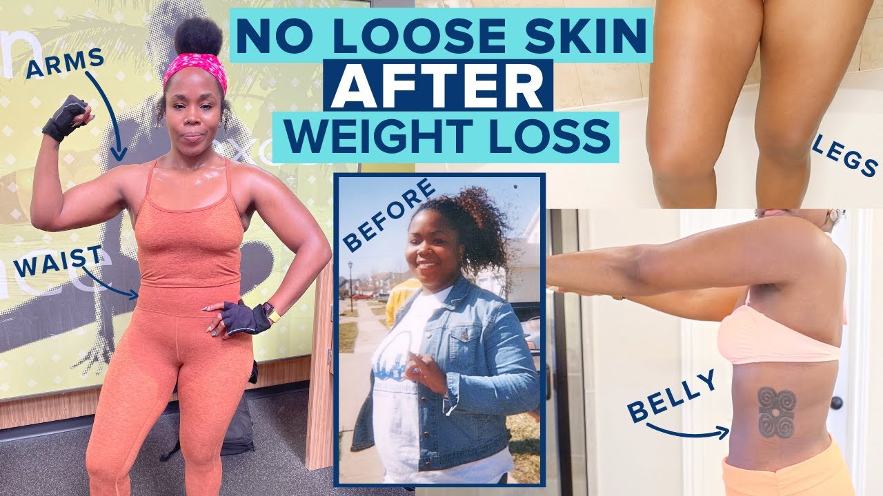 NO Loose Skin AFTER 100 Pound WEIGHT LOSS | How I Keep My Body TONED & SNATCHED With No Surgery