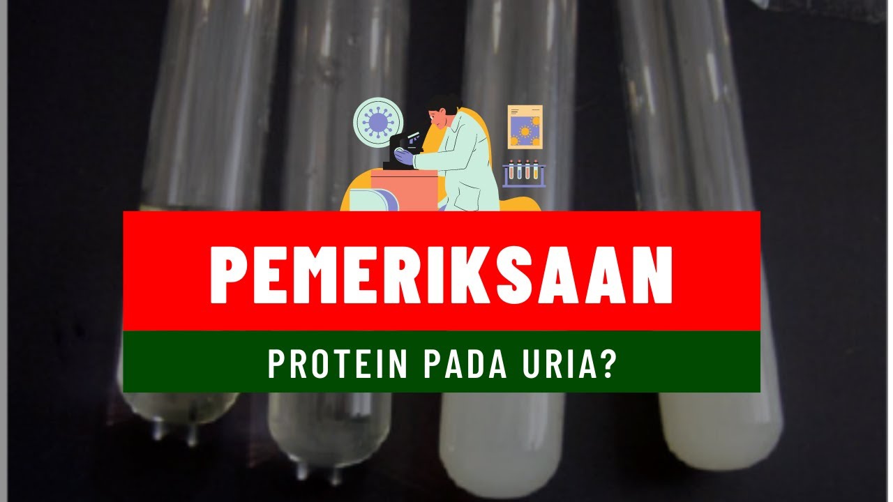 BAGAIMANA CARA MEMERIKSA PROTEIN PADA URIA?