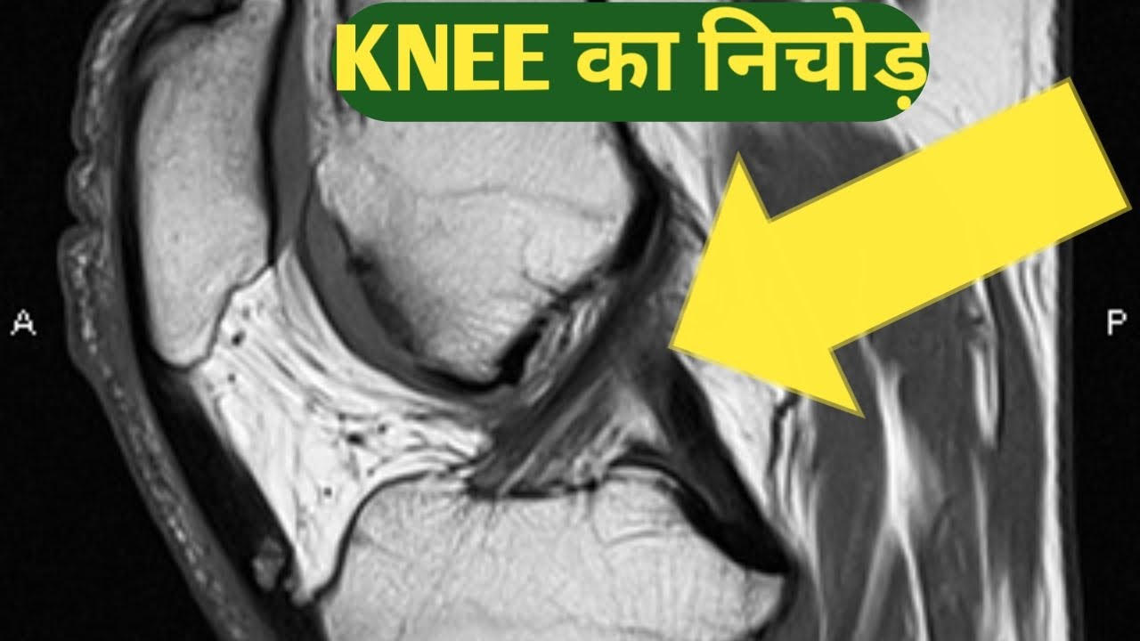 Mri @KNEE@ full planning with deeply anatomy in single video for beginner's