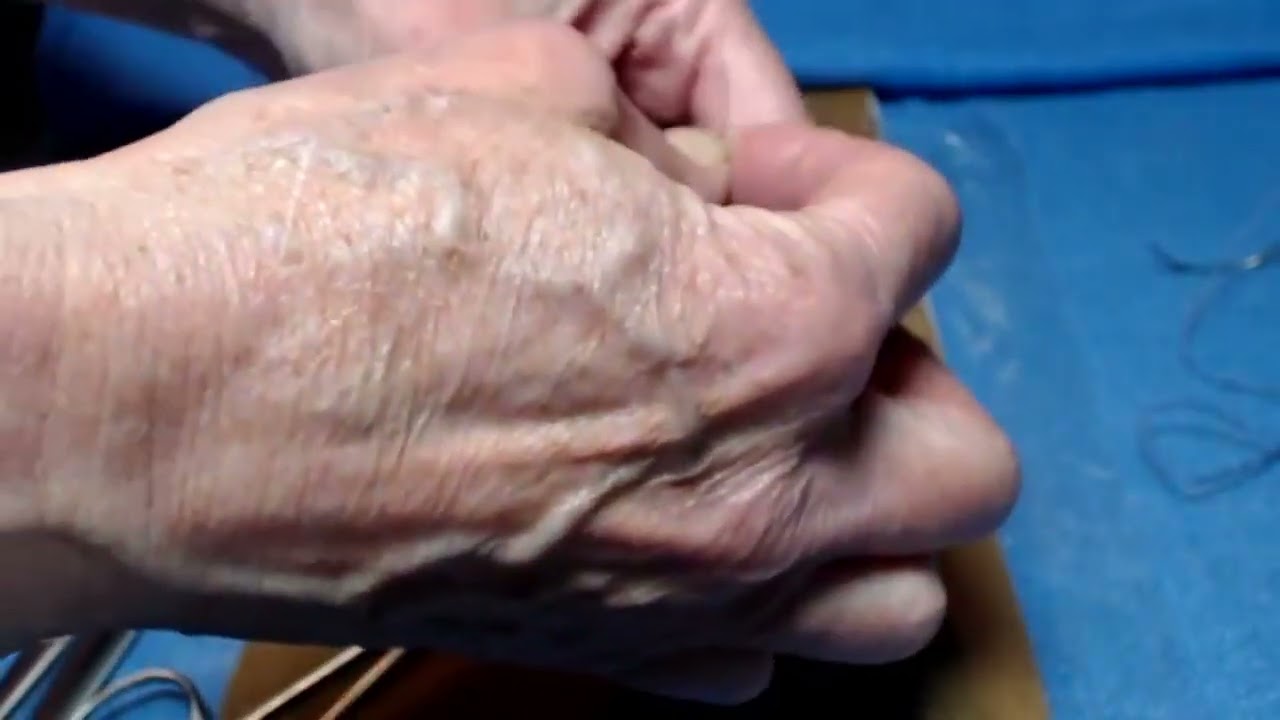 Free-ties and Figure 8 Stitches V 1 29 22