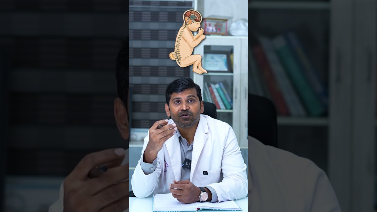 👶 Can we detect Congenital Diaphragmatic Hernia (CDH) before birth? 🤔#cdh #pregnancyscan#babyhealth