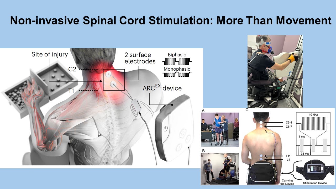 Non-Invasive Spinal Cord Stimulation: More Than Movement