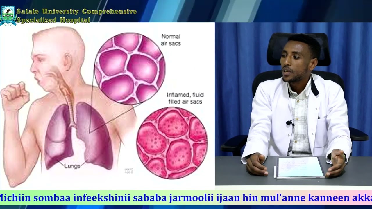 Hubannoo Barnoota Fayyaa Dhukkuba  Sombaa (pneumonia)
