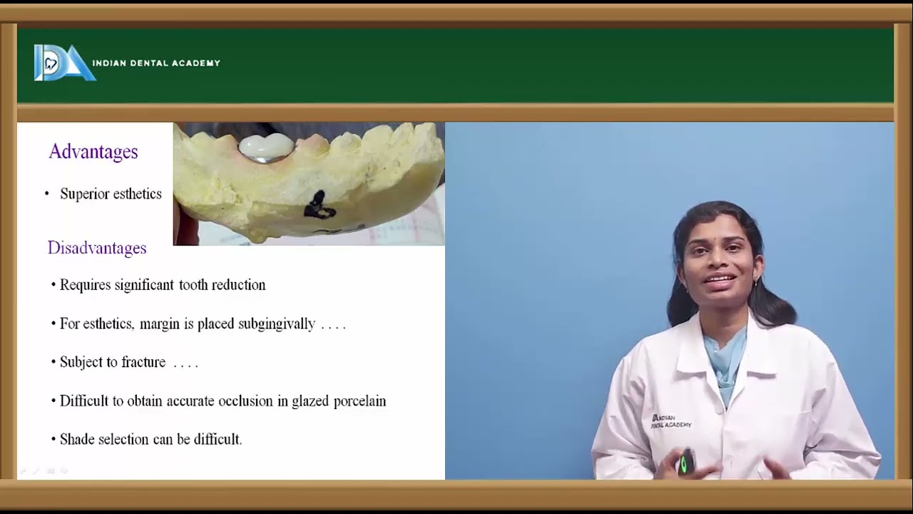 Full veneer crowns | Prosthodontics | #DDS#MDS#BDS#NBDE#NEET
