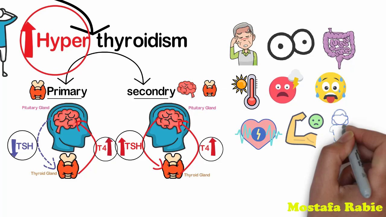 4- الغدة الدرقية وطريقة عملها ووظيفتها والامراض التي تسببها واعرضها ( Thyroid Gland )