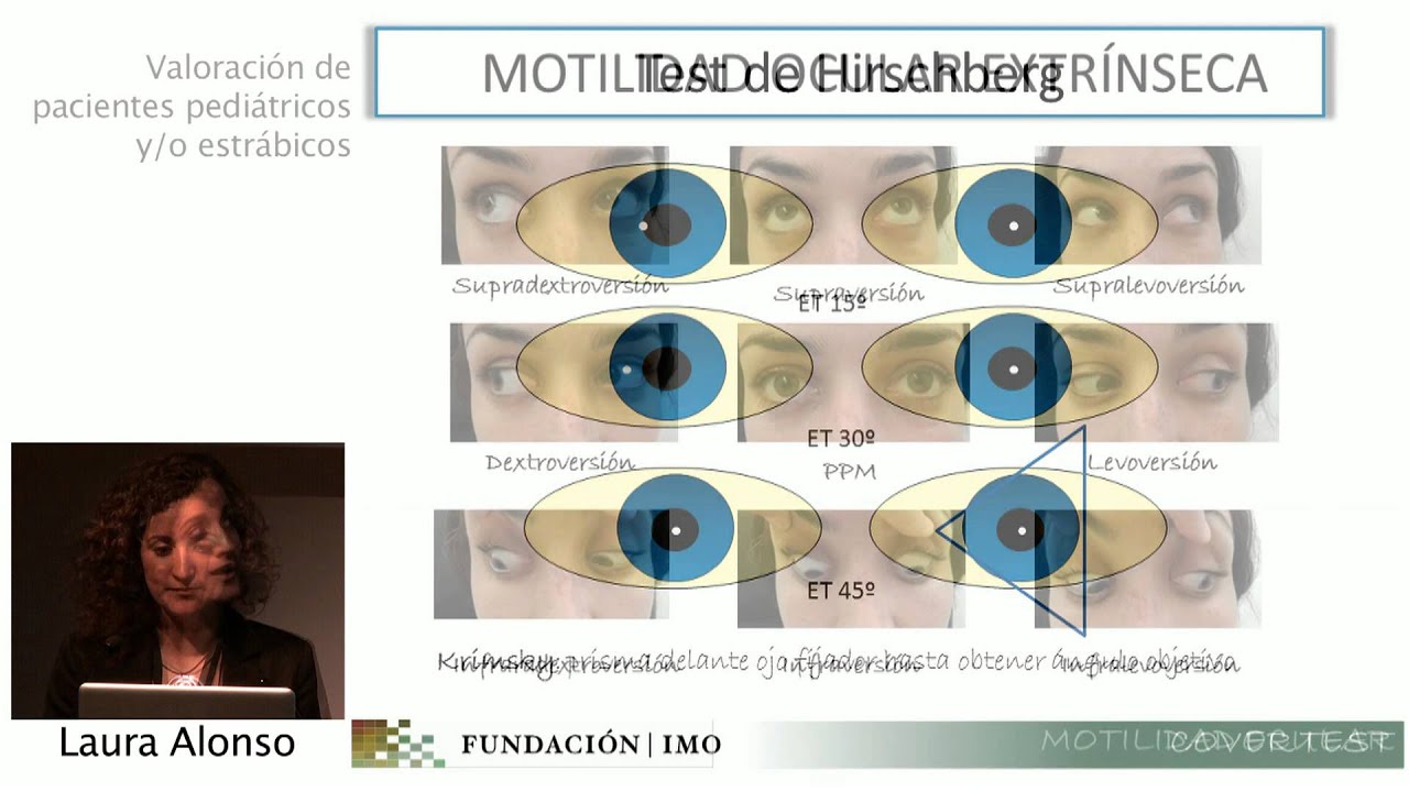 Cover Test y Motilidad Ocular Extrínseca