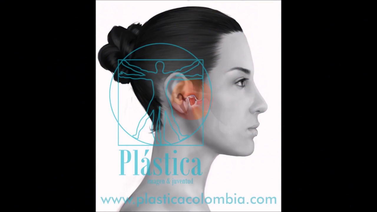 Cirugía articulación temporomandibular (ATM) / Dra. Sandra Nieto