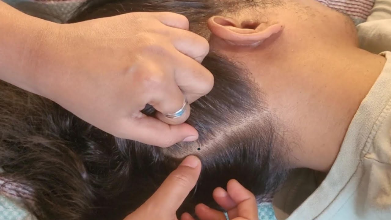 🤯 ULTIMATE SCALP CHECK ASMR: TINGLES GUARANTEED! 🤯