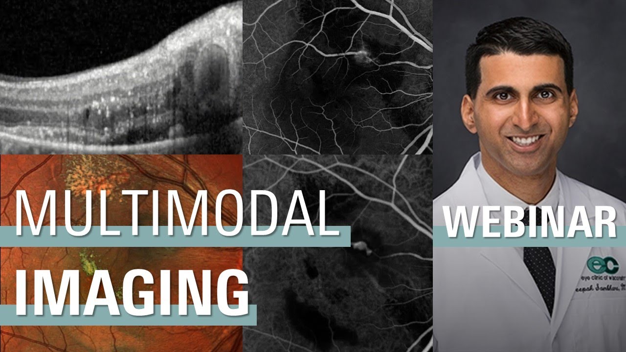Comprehensive Applications Of Multimodal Imaging | SPECTRALIS