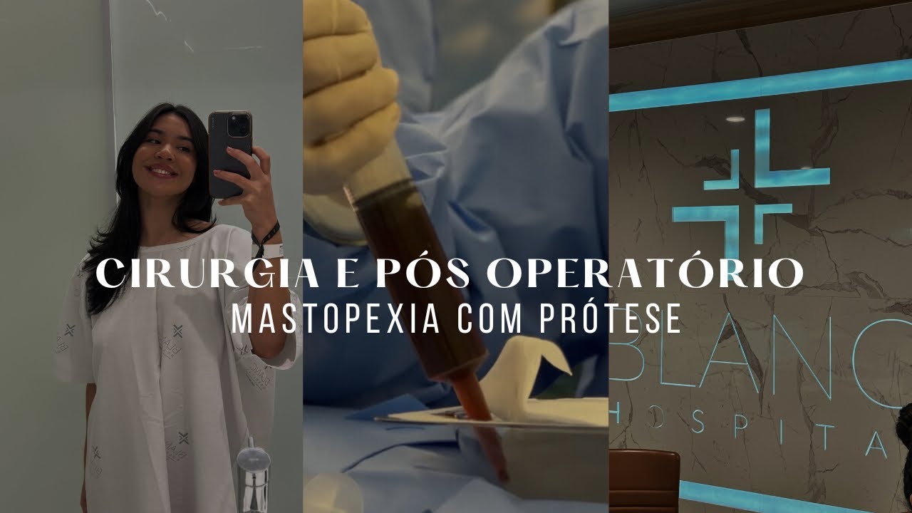 VLOG: MASTOPEXIA COM PRÓTESE | Cirurgia e pós operatório