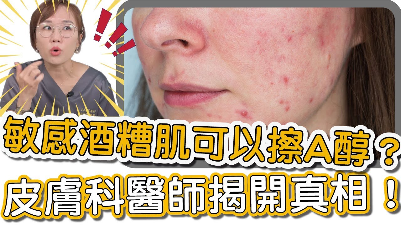 酒糟性肌膚真的能用使用A醇護膚嗎？皮膚科專科醫師莊盈彥來跟你說明！