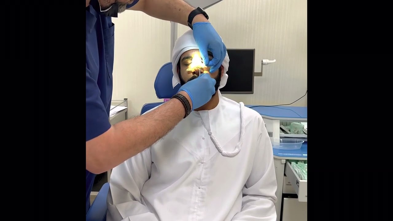 ازالة الدعامه الخارجيه بعد عمليه تجميل الانف و الحاجز الانفي باسبوع