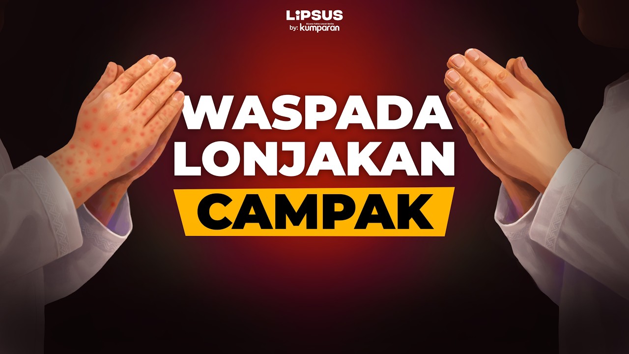 Waspada Campak Saat Mudik Lebaran, Kasusnya Naik Tajam di Indonesia | LIPSUS