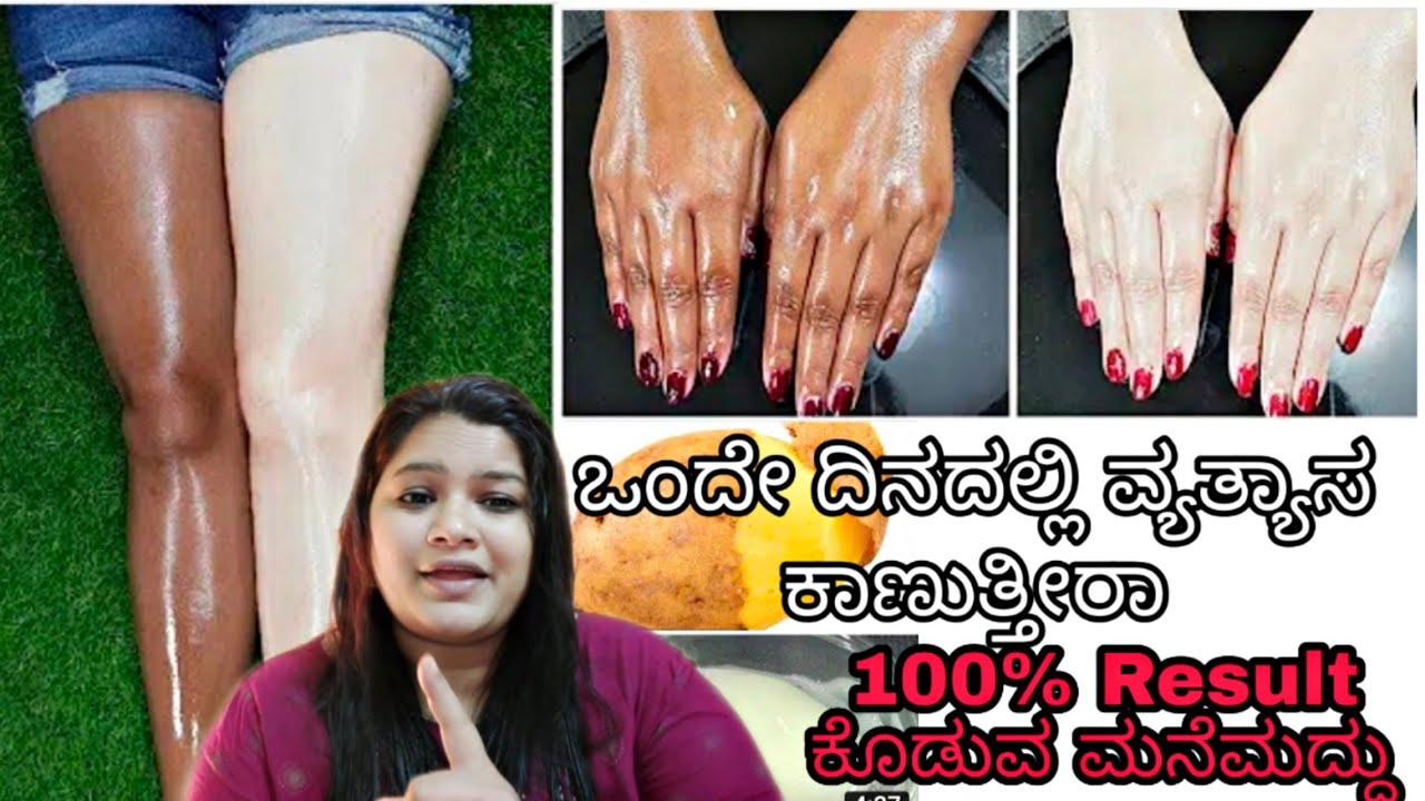 ದಿನಕ್ಕೆ ಒಂದು ಸಲ ಇದನ್ನು ಹಚ್ಚಿದರೆ ಸ್ಕಿನ್ ವೈಟಾಗಿ ಹೊಳೆಯುತ್ತೆ|Skin Whitening And Glowing Home Remedy 2020