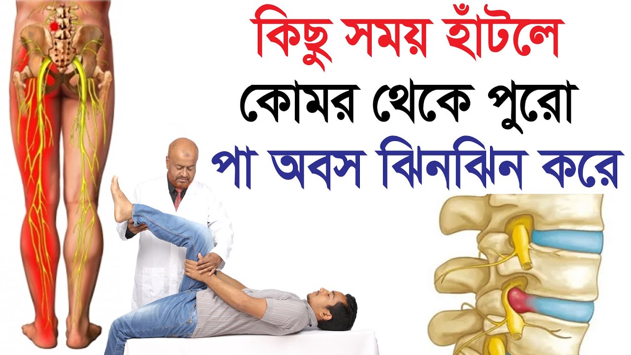 অল্প হাটলে কোমর থেকে পুরো পা অবস এবং ঝিমঝিম করে