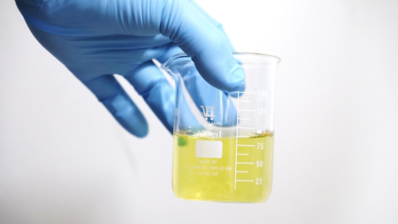Urine Culture? Infection?