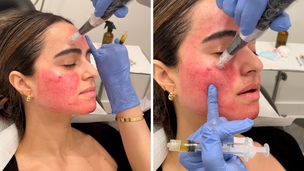 Делаю вампирскую маску для лица 💉 Вы должны увидеть эти результаты!!