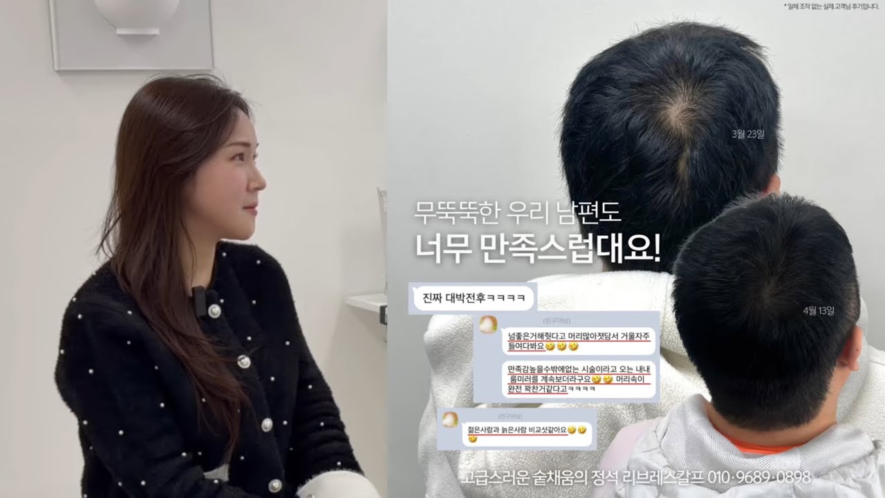 부천두피문신 40대 남성 정수리문신 10개월차 내돈내산 후기!
