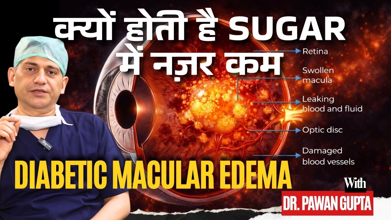 How Diabetic Macular Edema Develops & How It Affects Vision | Dr. Pawan Gupta