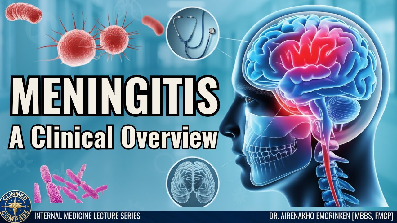 Meningitis: A Clinical Overview