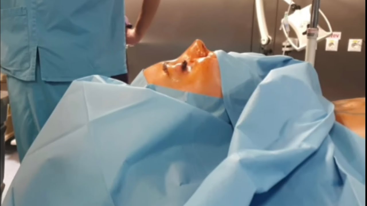 Ne.am făcut operație de rinoplastie și implant mamar @pascaldameh8435