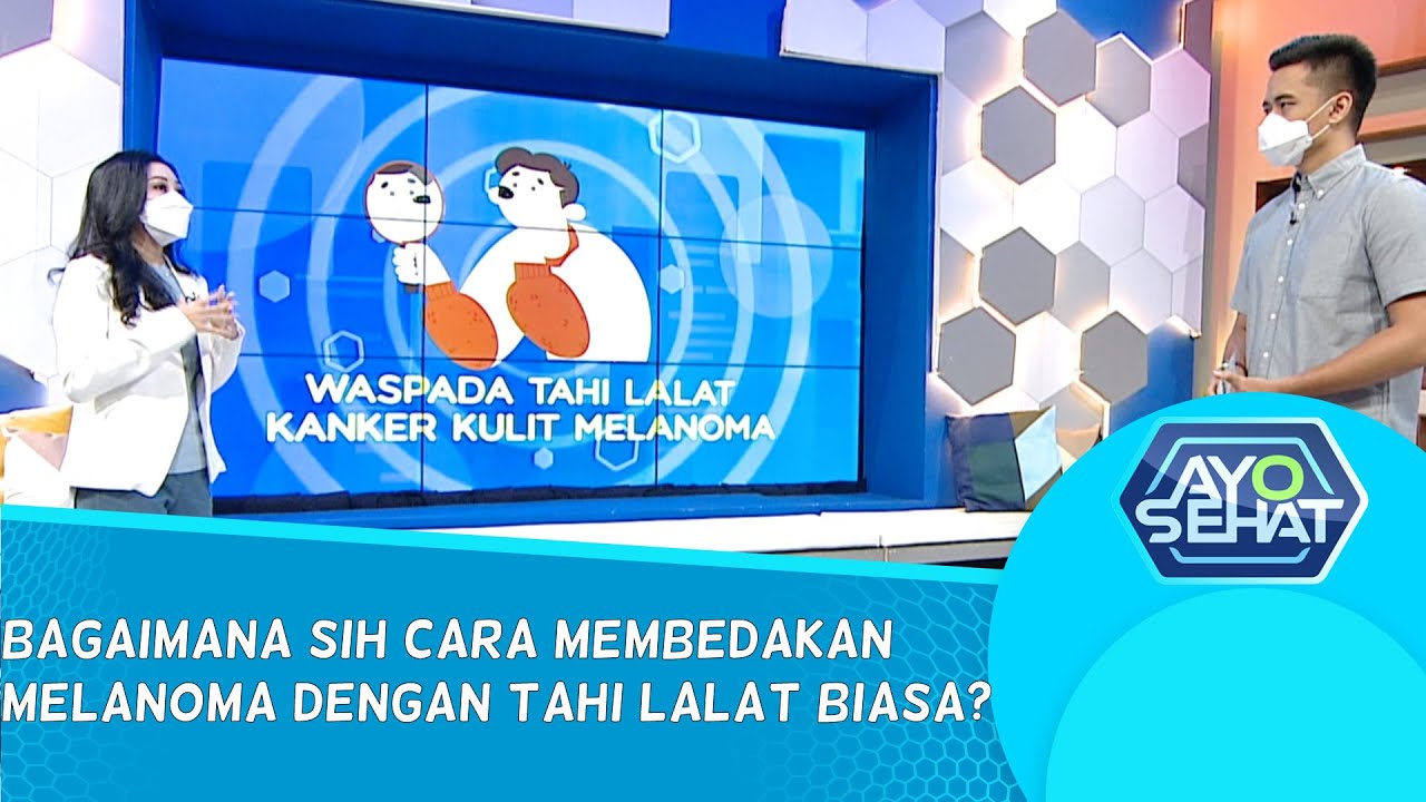 Waspada Bercak & Tahi Lalat Kanker Kulit Melanoma - AYO SEHAT