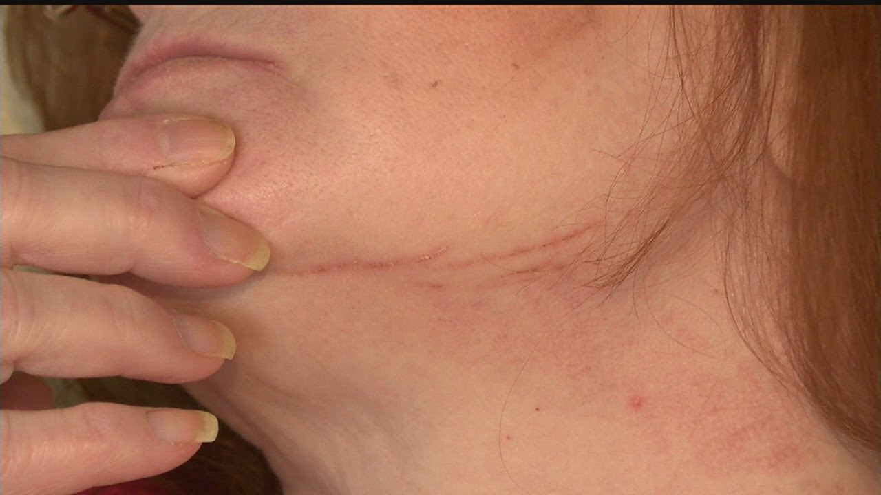 Woman slashed with box cutter