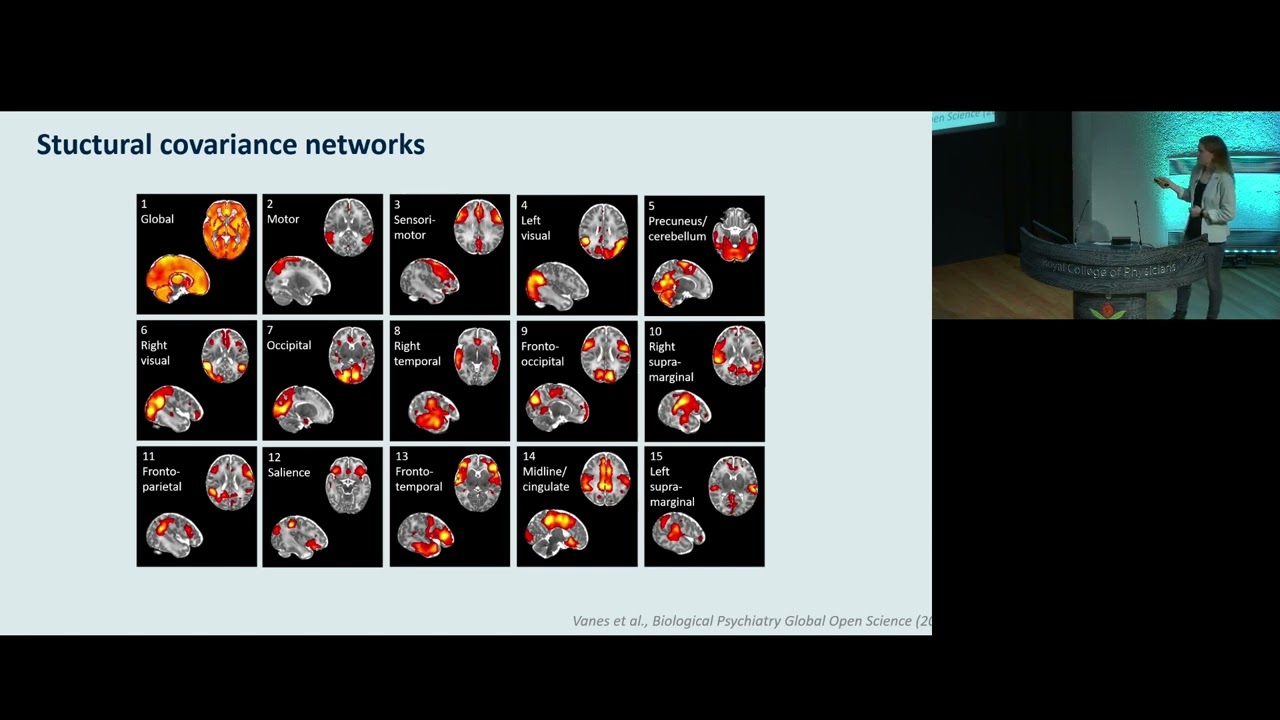 Effects of neurodevelopment on behavioural outcomes following preterm birth - Lucy Vanes