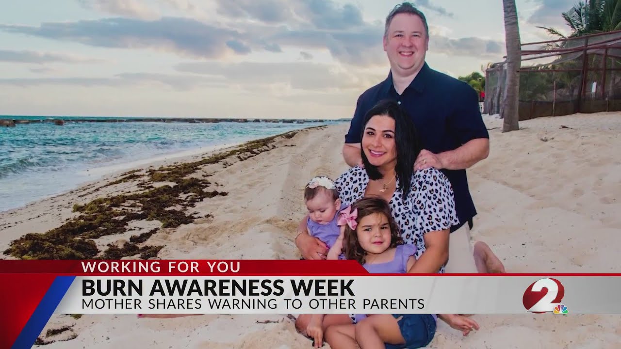 Burn Awareness Week: Mother shares warning to other parents