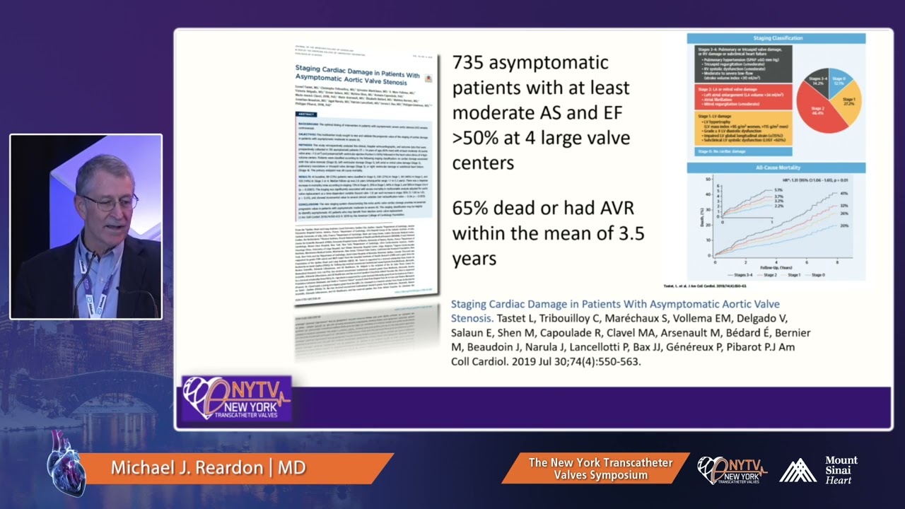 Michael J  Reardon, MD - TAVR in Asymptomatic or Moderate AS