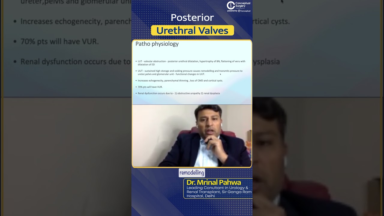 A Small overview on Posterior Urethral Valves by Dr. Mrinal Pahwa