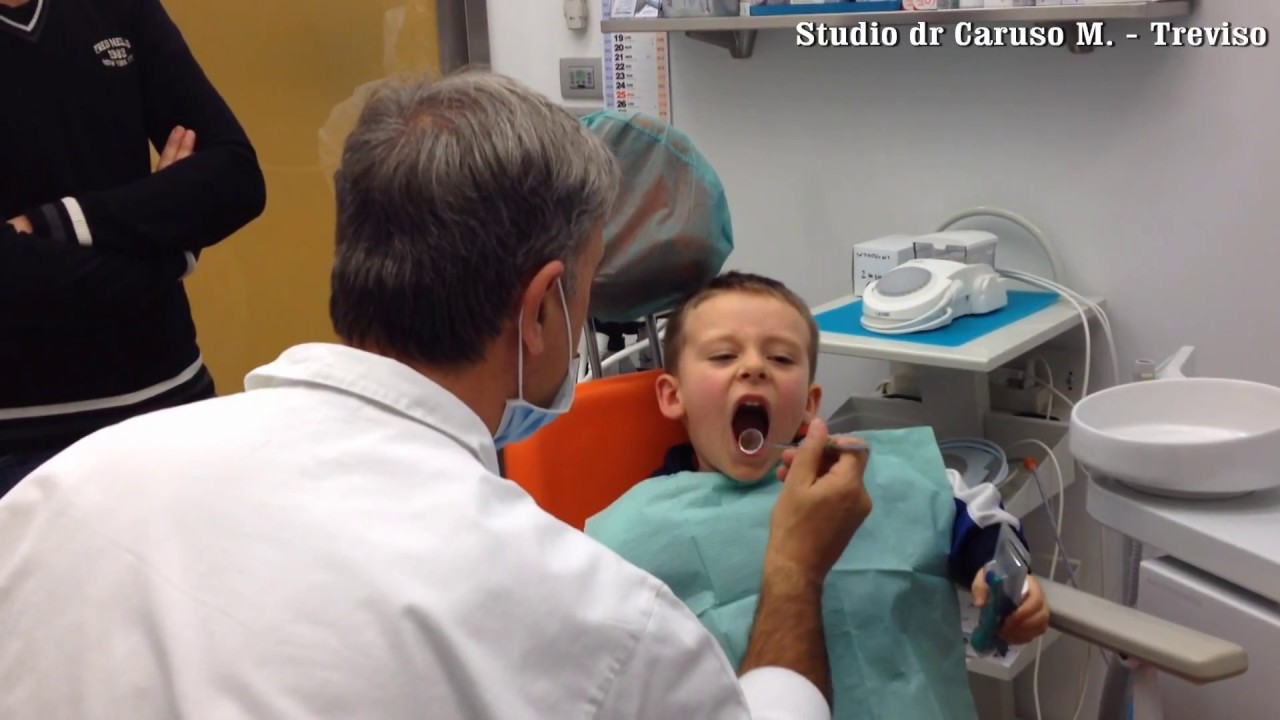 Paura del dentista sedazione protossido per cure denti decidui bimbo di 5 aa: 2a parte.