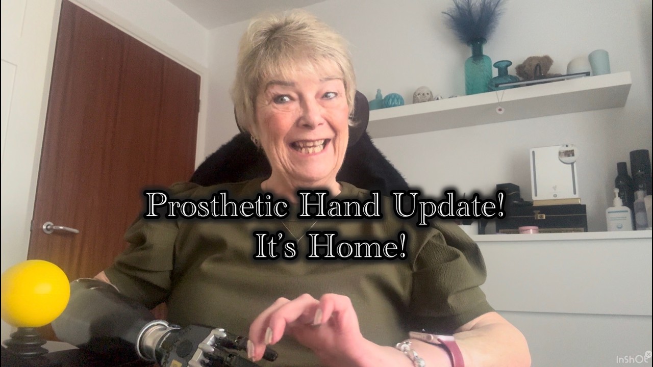 Prosthetic Hand Update!  -  It's Home!