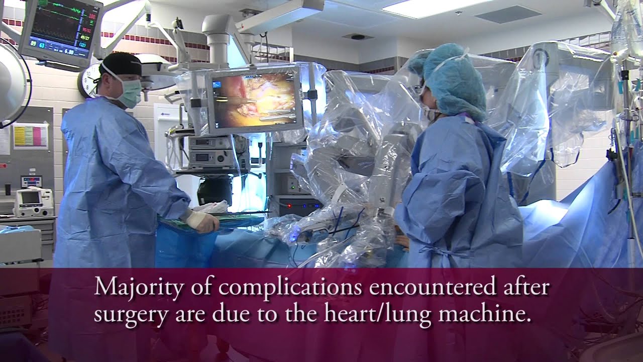TrinityTALK edu - TECAB - Minimally Invasive Coronary Artery Bypass Surgical Technique