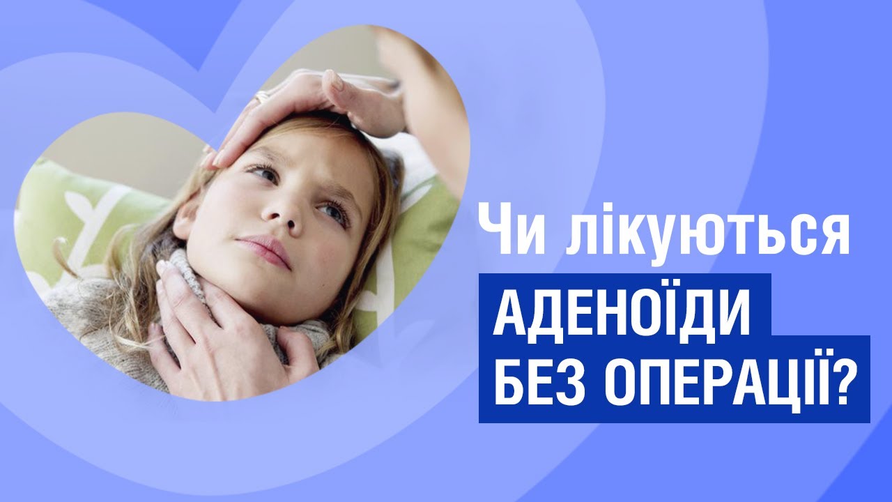 Лікування аденоїдів без операції? - міф чи правда. Відповідає лор-хірург