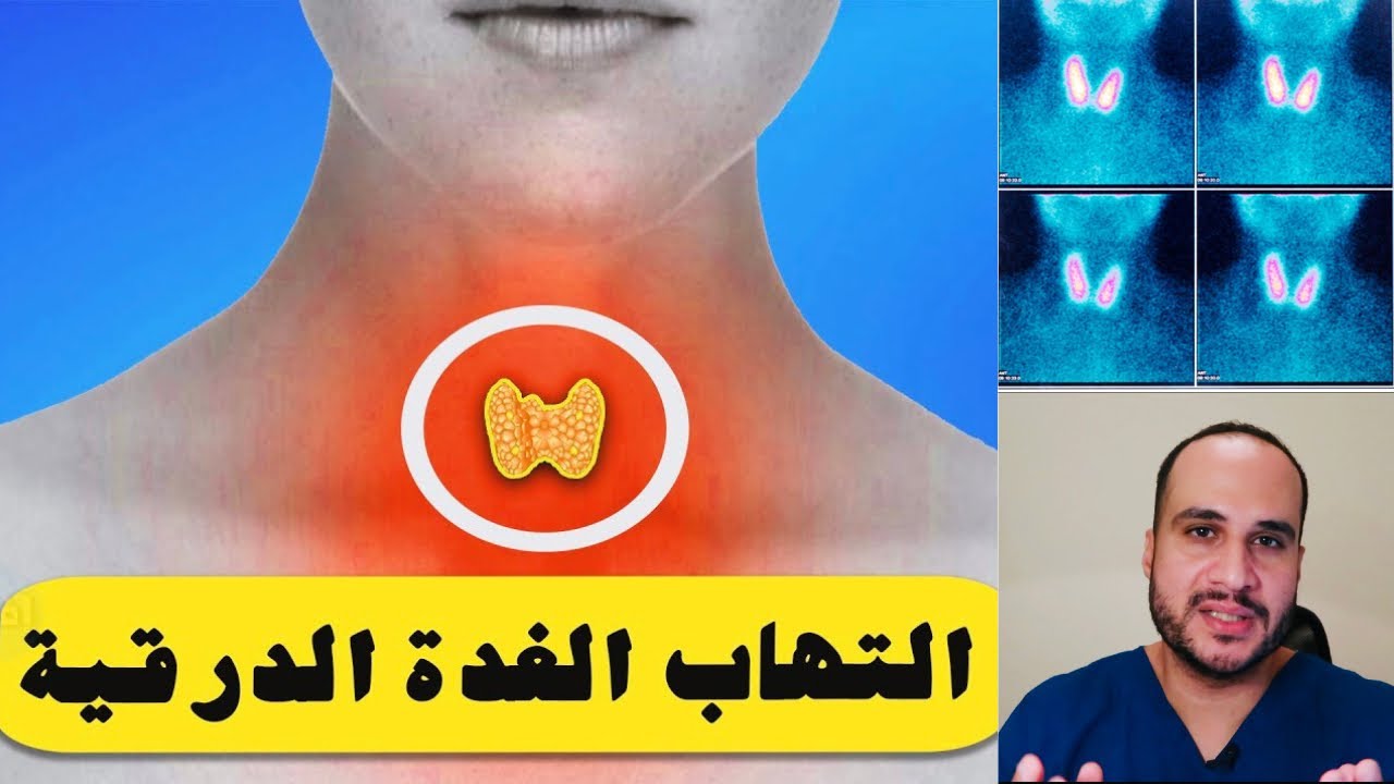٥- التهاب الغدة الدرقية ؟؟ ملخص بسيط..